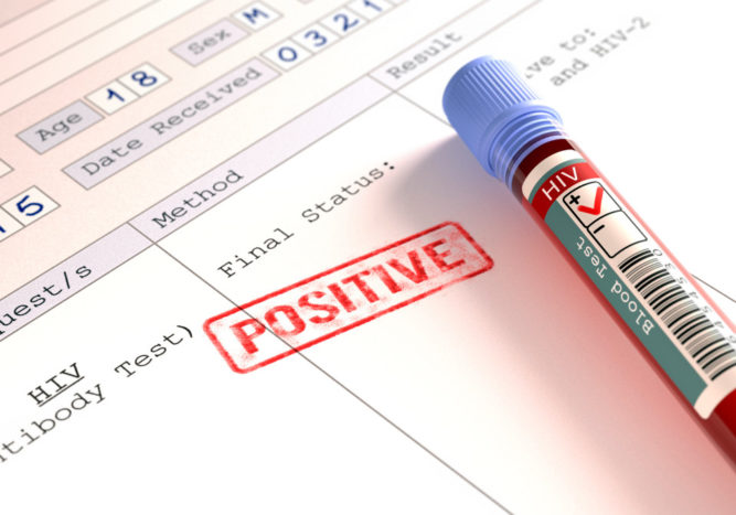 Rozpoznat časné příznaky infekce HIV