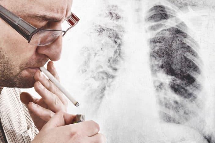 příznaky rakoviny plic