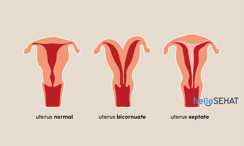 abnormality v děloze