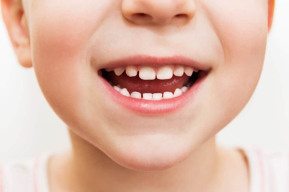 mléčné problémy s zuby