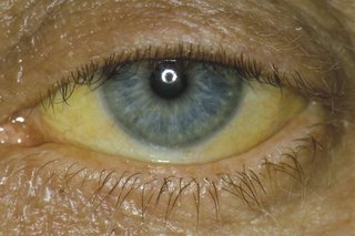žluté oči