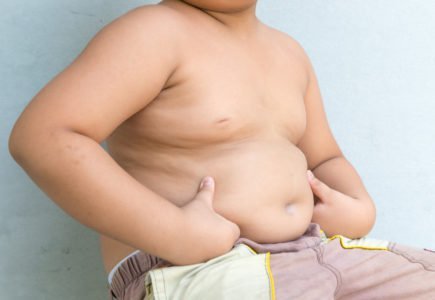 obezita u dětí