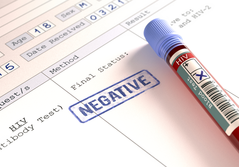 význam výsledků negativního testu HIV