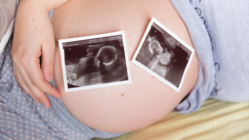 riziko ztráty těhotných dvojčat zmizí