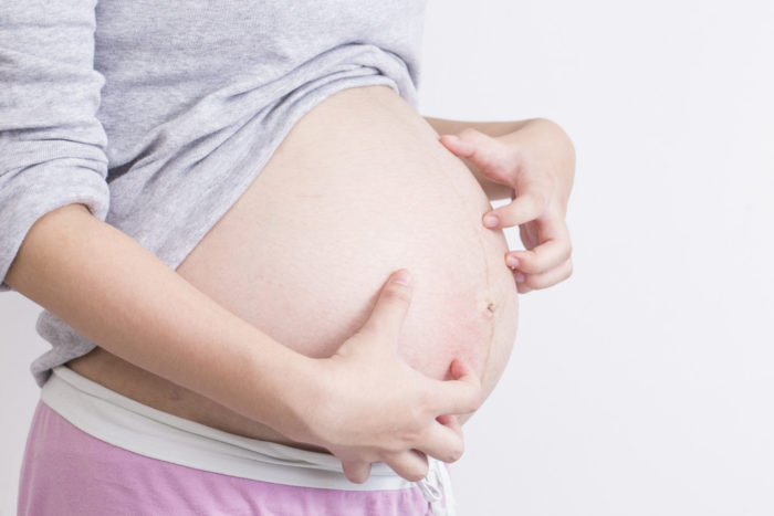 Svrběná folikulitida je příčinou svědění kůže během těhotenství