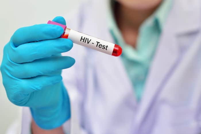 HIV krevní test